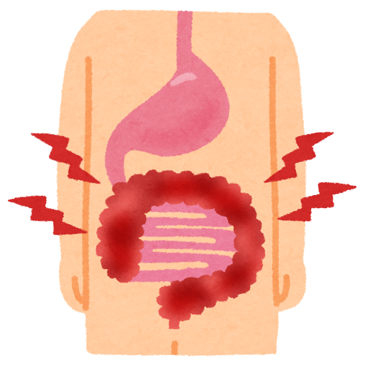 虚血性大腸炎（きょけつせいだいちょうえん）